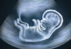 shutterstock_ultrasound